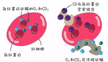 警惕洗澡季隱形殺手 一氧化碳中毒康復后，當心遲發性腦病
